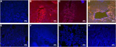 Effects of Simultaneous Downregulation of PHD1 and Keap1 on Prevention and Reversal of Liver Fibrosis in Mice